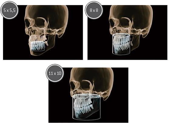 Scans from Latest 3D Cone Beam Scanner used at Bridge Dental