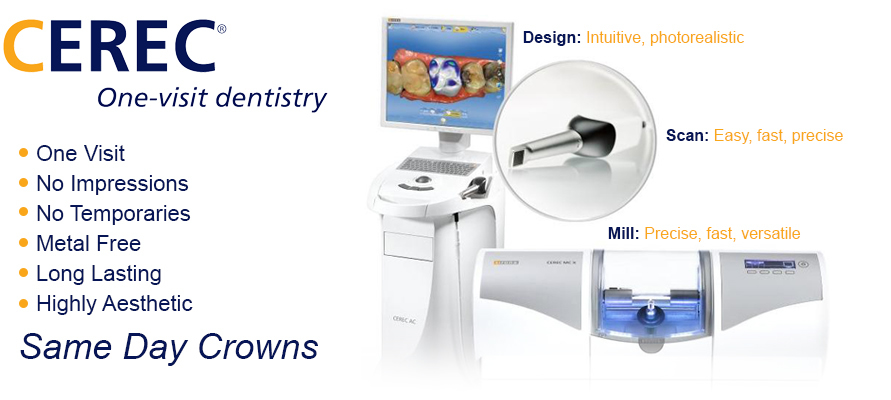 CEREC One Visit Dentistry - beautiful restorations - same day crowns