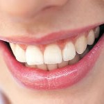 Teeth Whitening Improves your smile and confidence